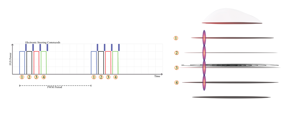 Timing diagram: PWM pulses numbered 1 to 4 with electronic steering commands between them, and the corresponding four focal depths stacked along the beam axis.